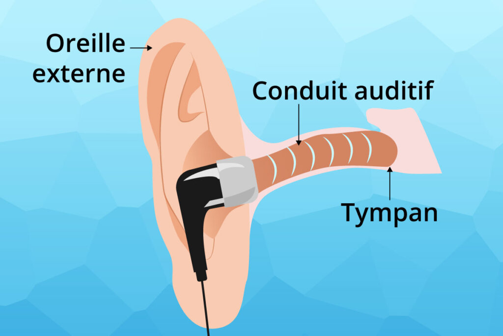 diagramme de placement des écouteurs intra-auriculaires